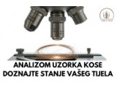 Analizom uzorka kose doznajte stanje vašeg tijela